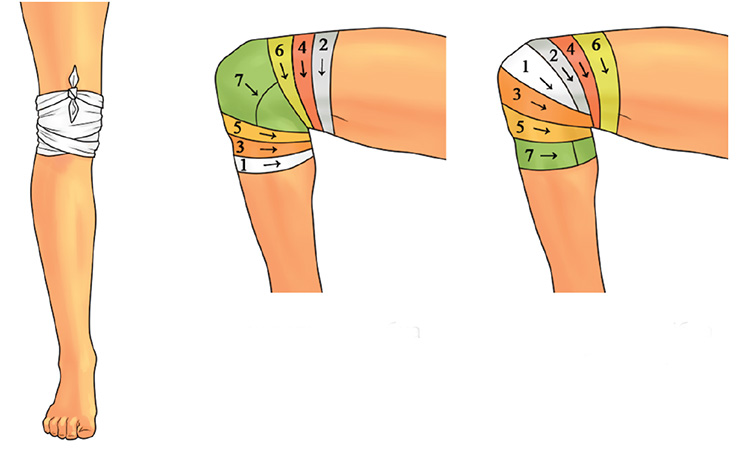 Пов’язки на коліно