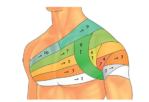 Пов’язка на плечовий суглоб